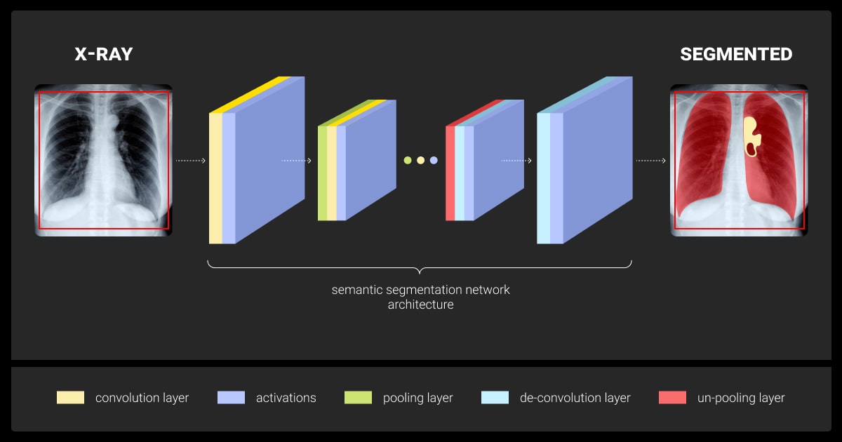 Typical process of segmentation with CNN