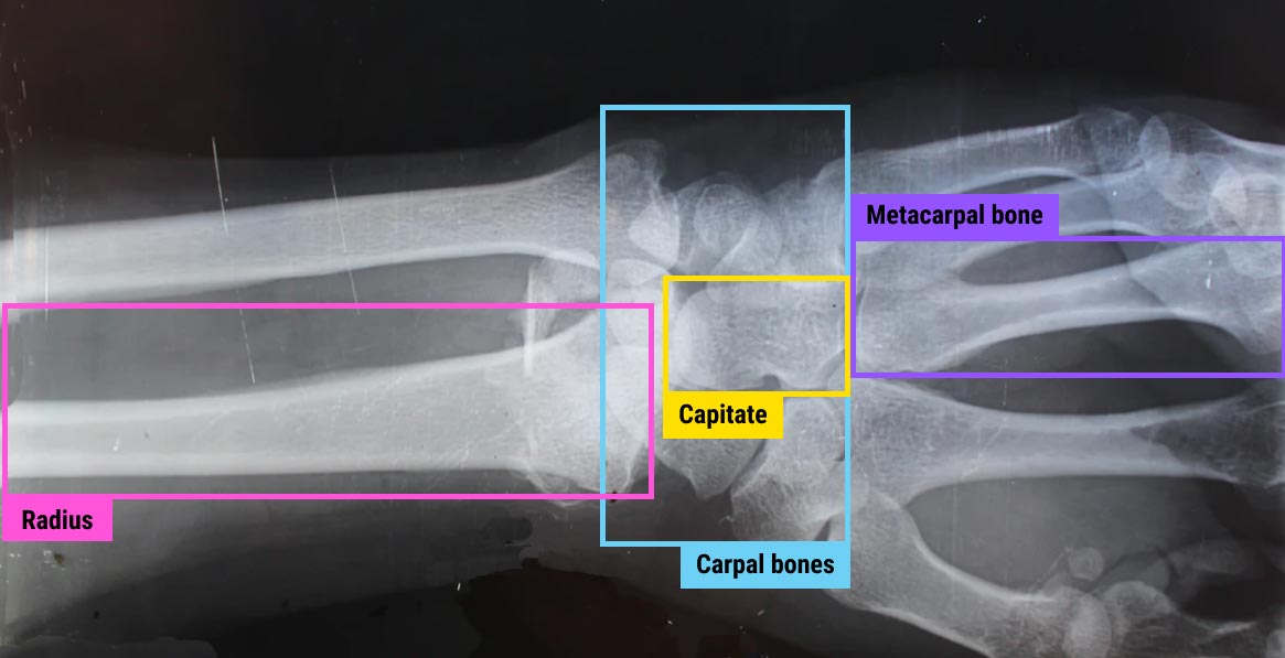 X-Ray data annotation