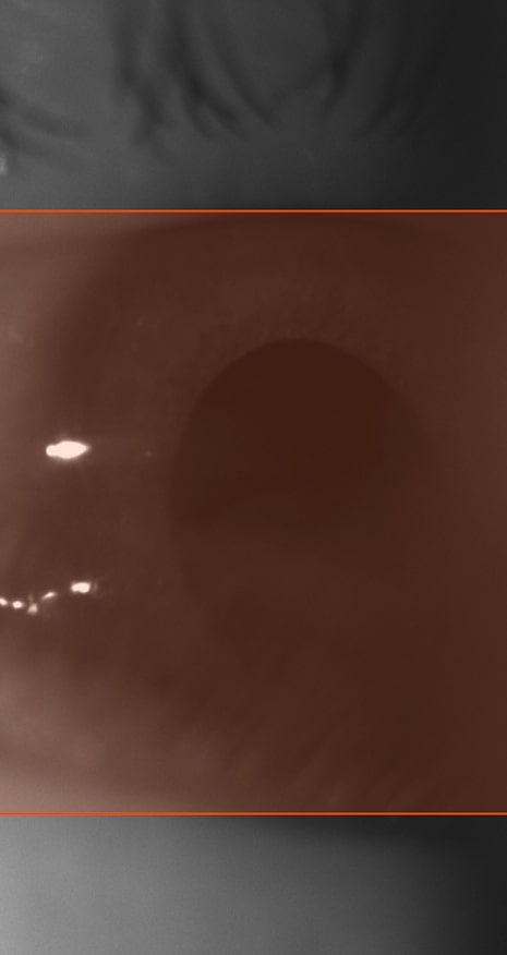 Close-up of a human eye used for AI-based pupil detection and segmentation