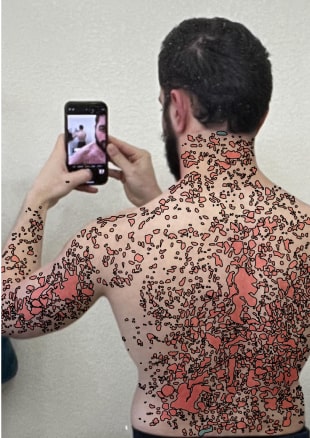 Annotated image of a man with skin markings used for AI training