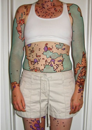 Annotated photo showing body segmentation and labeled areas