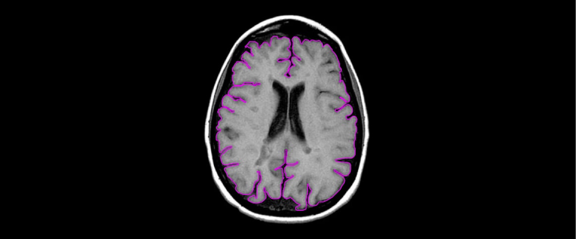 An example of contour annotation for MRI organ segmentation