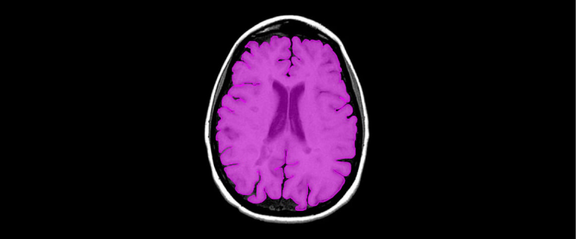 An example of instance segmentation for MRI organ segmentation