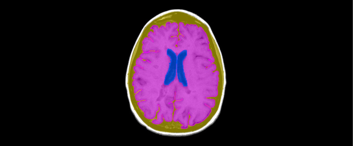 An example of semantic segmentation for MRI organ segmentation